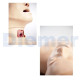 Cabeza Intubacion Dificil Adulto 